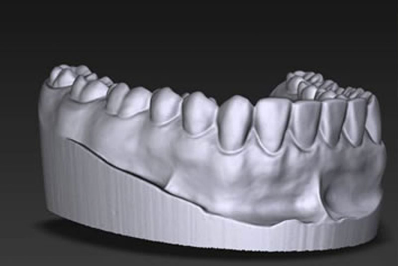 tech scan invisalign