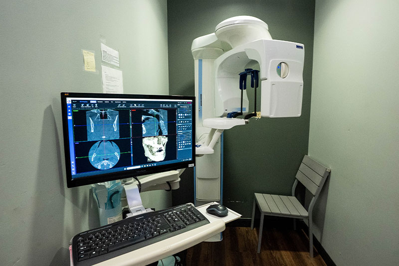 X-ray Machine