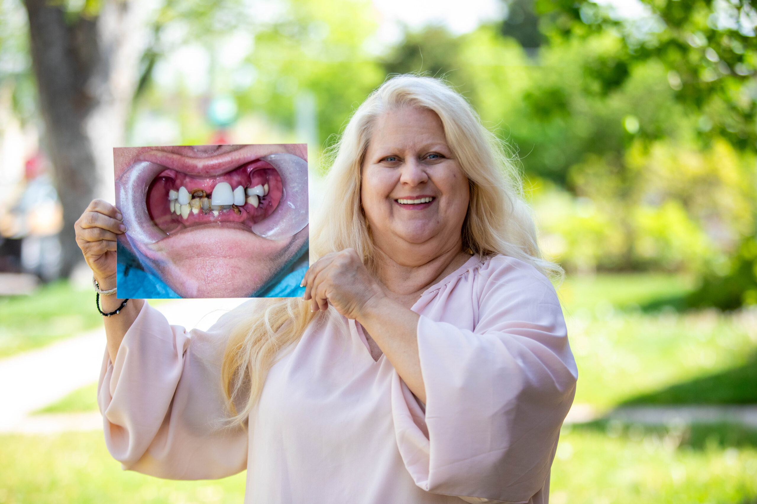 Patient holding up a before and after photo of their teeth before dental procedure