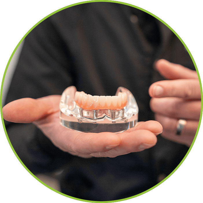 Full Arch Model