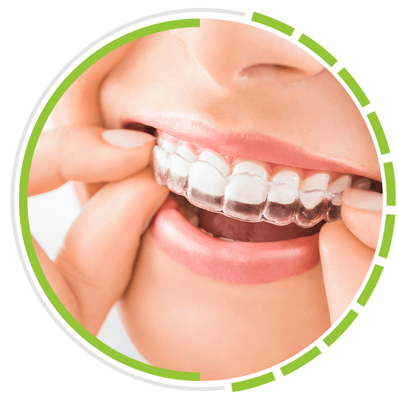 Invisalign