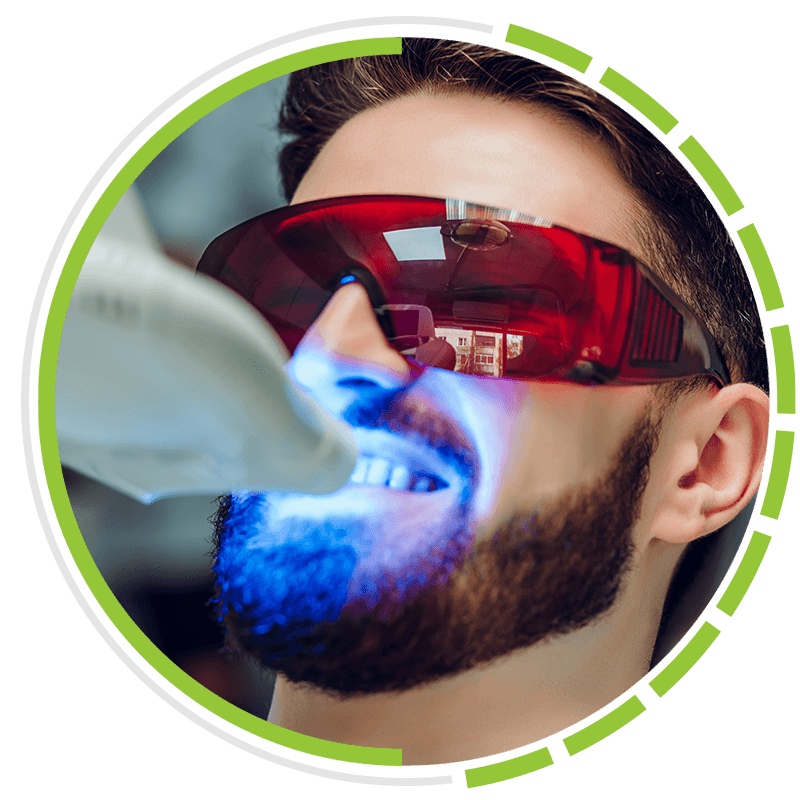 teeth whitening
