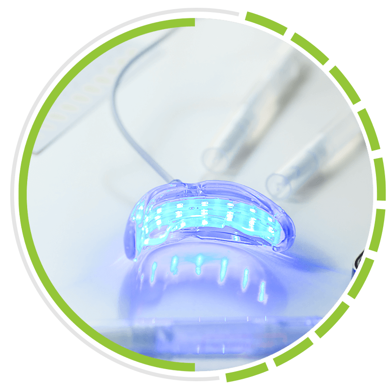 teeth whitening