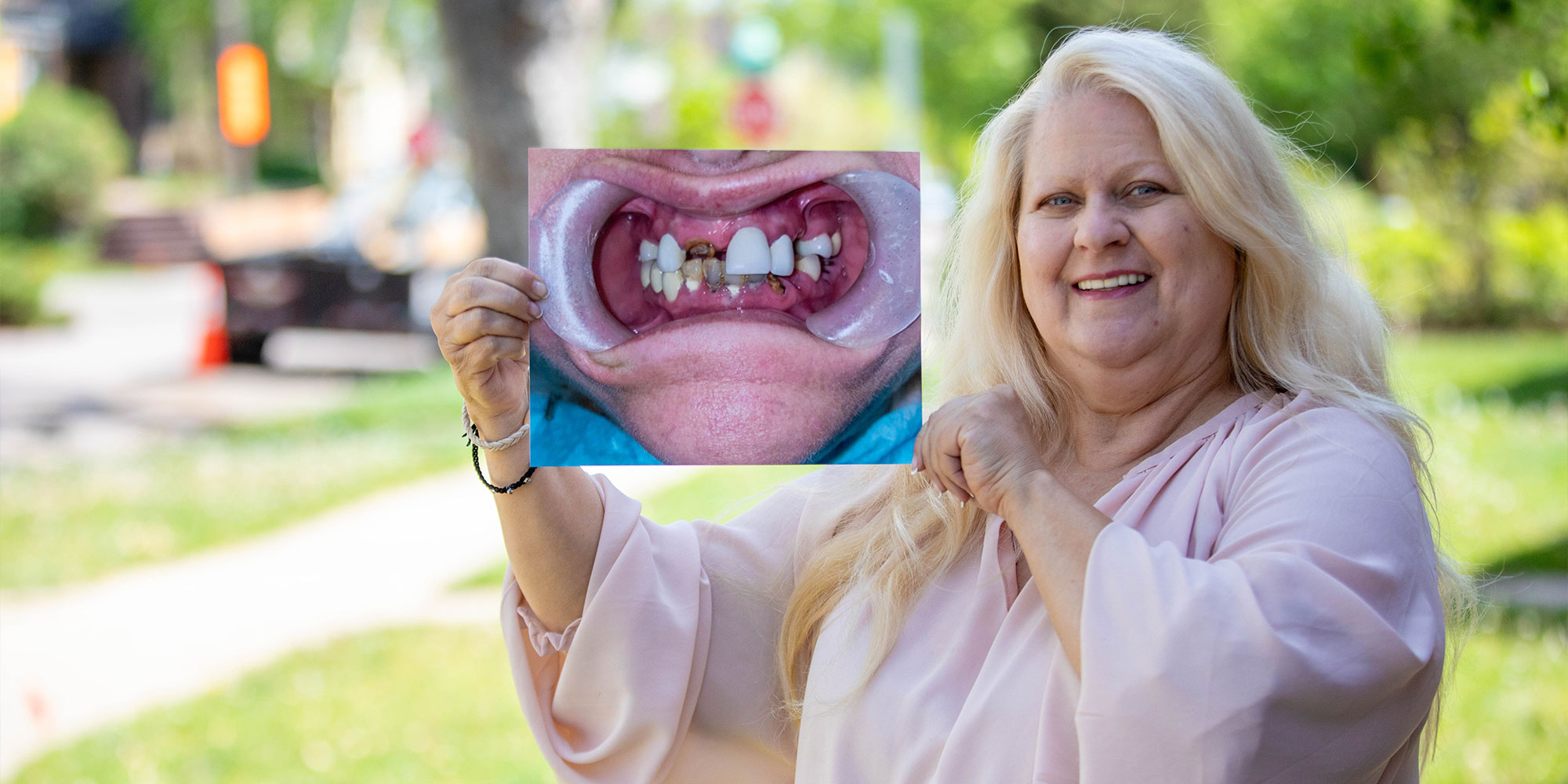 Woman holding before and after photo of her teeth before dental procedure